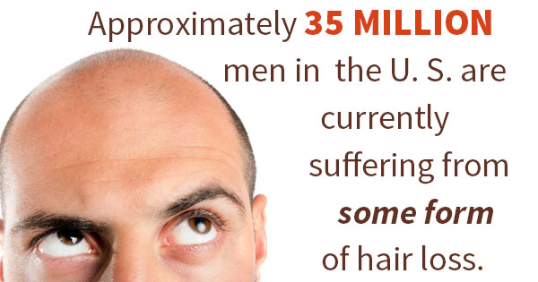 Common Causes of Hair Loss - LA FUE Hair Clinic – Los Angeles FUE Hair  Transplant Clinic