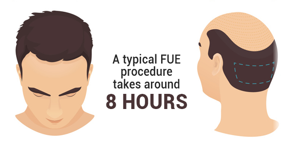 Preparation Checklist For Your Hair Transplant Surgery - LA FUE Hair Clinic  – Los Angeles FUE Hair Transplant Clinic
