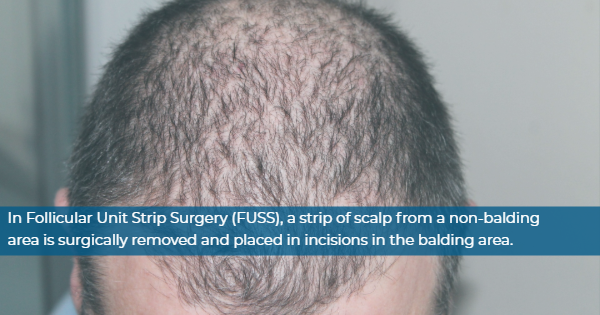 hair transplant clinic