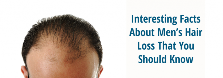 Interesting Facts About Mens Hair Loss That You Should Know La Fue