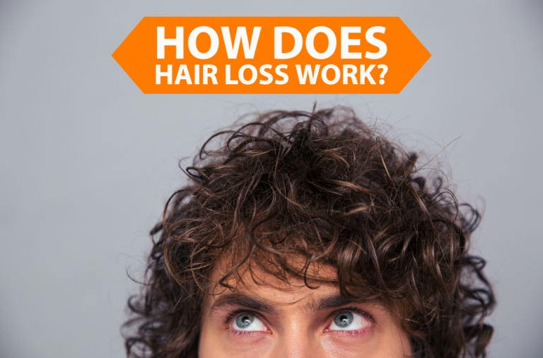 How Does Hair Loss Work? LA FUE Hair Clinic Los Angeles FUE Hair