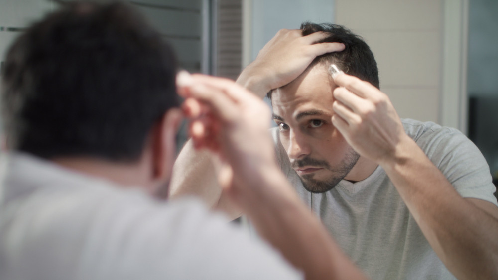 male hair loss specialist