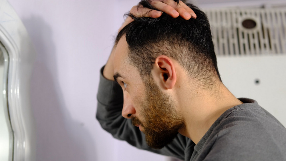 how to treat hair loss